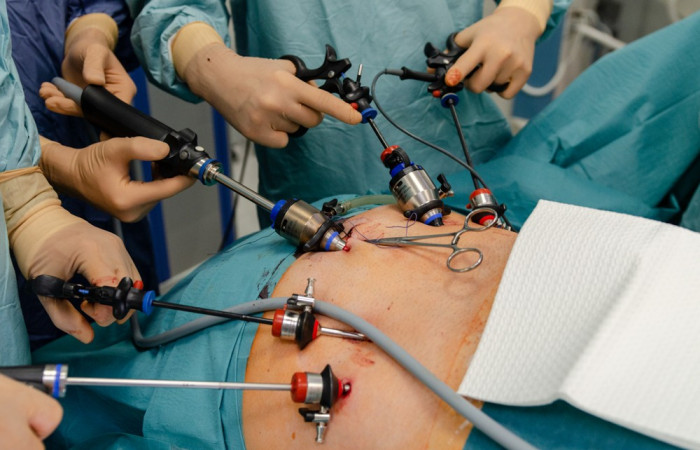 Operacja laparoskopowa