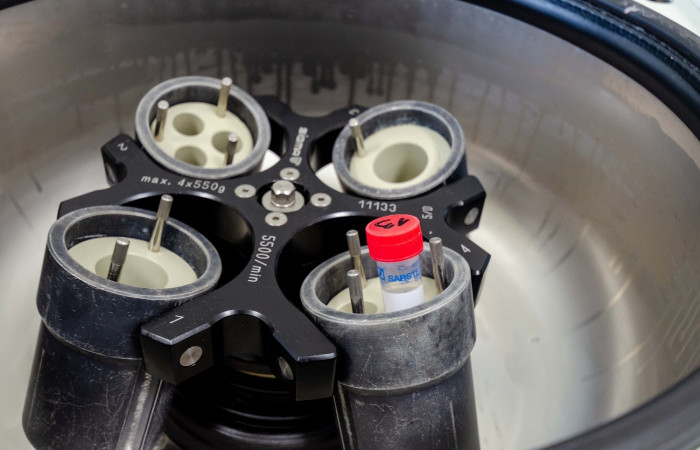 Sprzęt Zakładu Diagnostyki Hematologicznej i Genetyki - zbliżenie