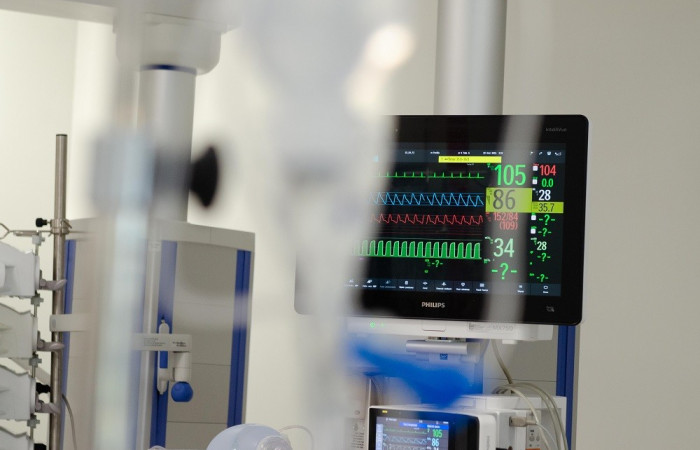 kardiomonitor 