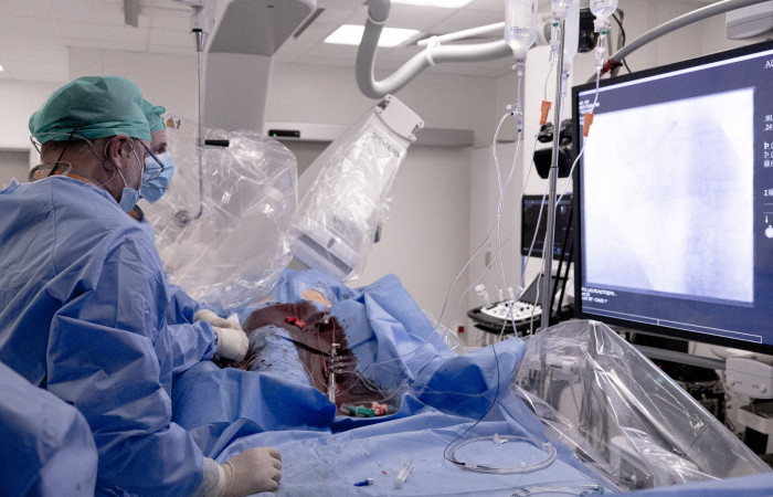 Operacja udrożnienia przewlekłych okluzji tętnic