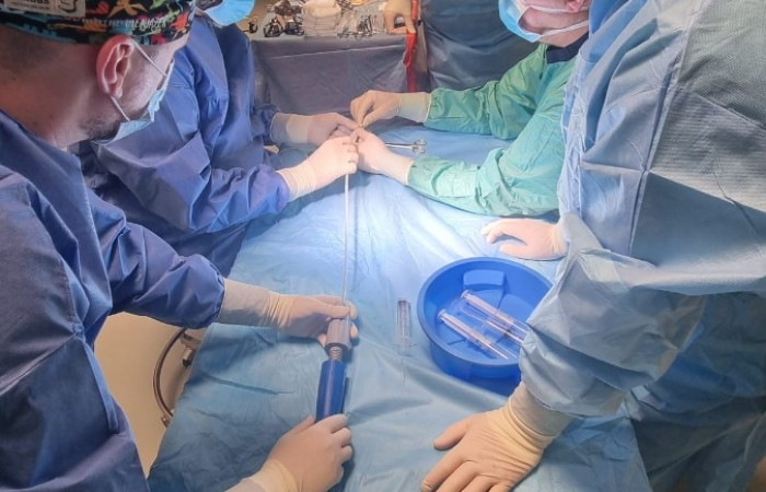 operacja wszczepienia stentgrafu