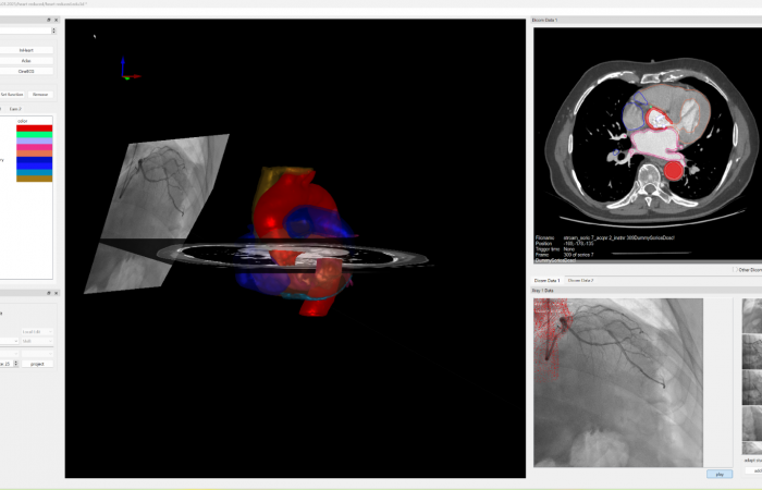Pracownia Funkcjonalnego i Wirtualnego Medycznego Obrazowania 3D