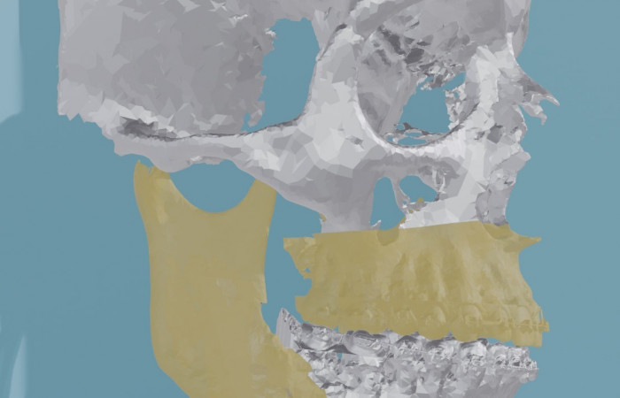 Pracownia Funkcjonalnego i Wirtualnego Medycznego Obrazowania 3D