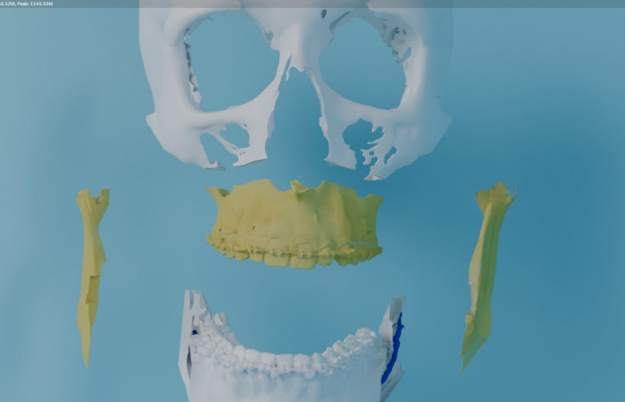 Pracownia Funkcjonalnego i Wirtualnego Medycznego Obrazowania 3D