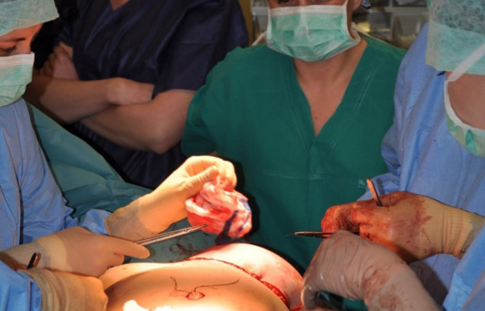 nowoczesne_techniki_leczenia_chorob_piersi_2