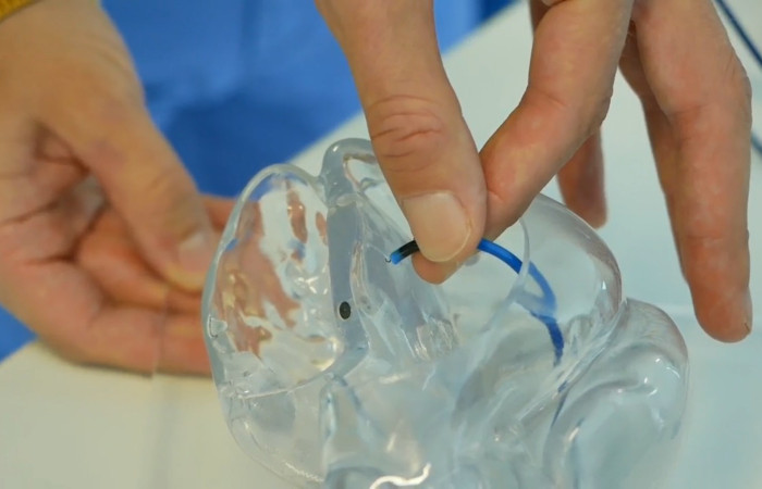 model serca z z wszczepioną sondą