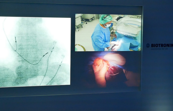 zdjecie transmisij z operacji on line